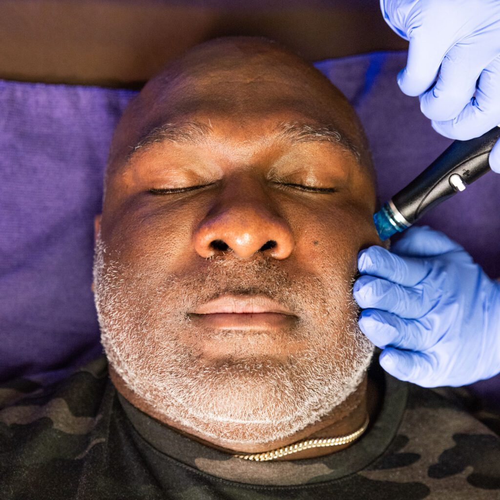 Hydrafacial treatment in progress
