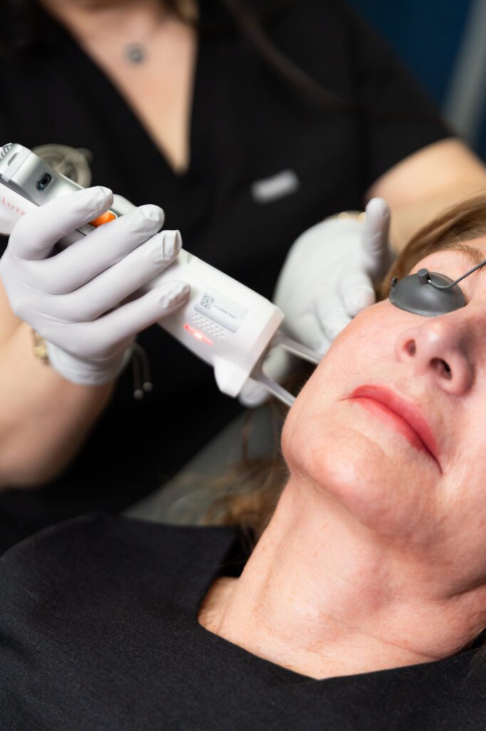 A woman is having a laser pressed up to her face for acne scar removal treatment.