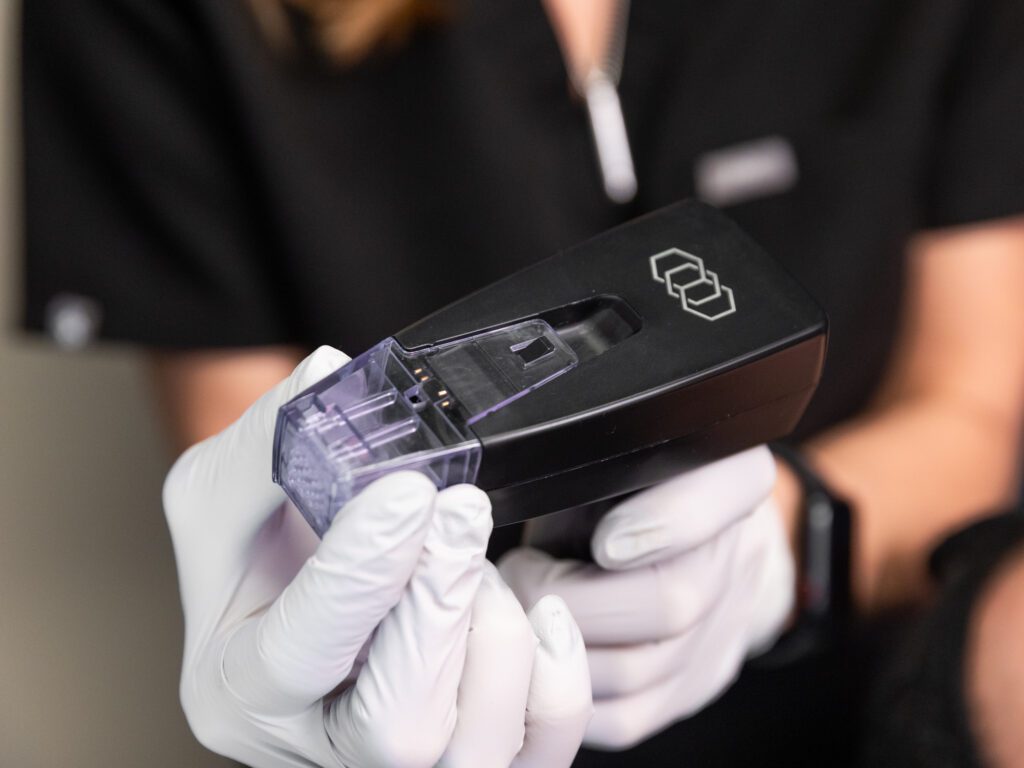 A Xanadu Med Spa medical professional is holding a laser device and is administering treatment for acne scar removal.