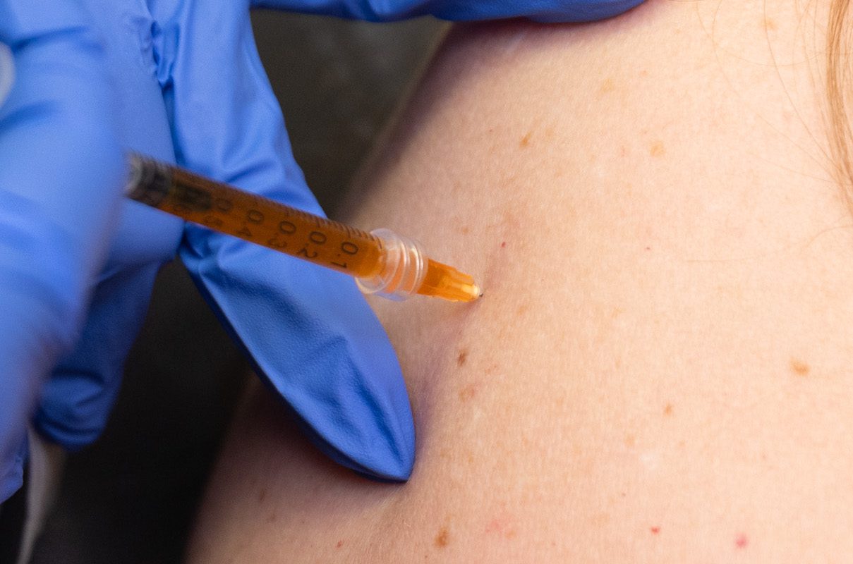 A nurse is administering semaglutide as an appetite suppressant in Fort Collins.