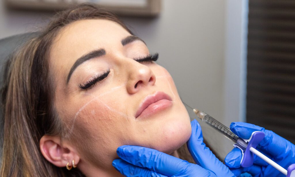 A woman is lying down and preparing for undereye filler in Fort Collins.